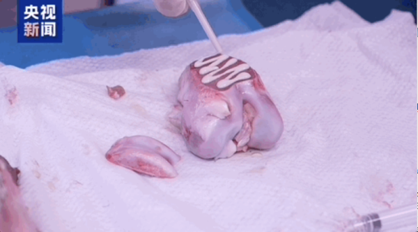 断骨1.png 断骨1.png