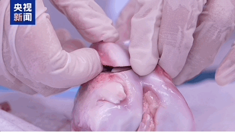 断骨2.png 断骨2.png