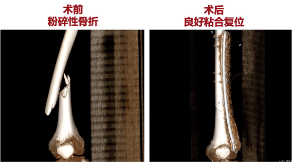 图4.png 图4.png